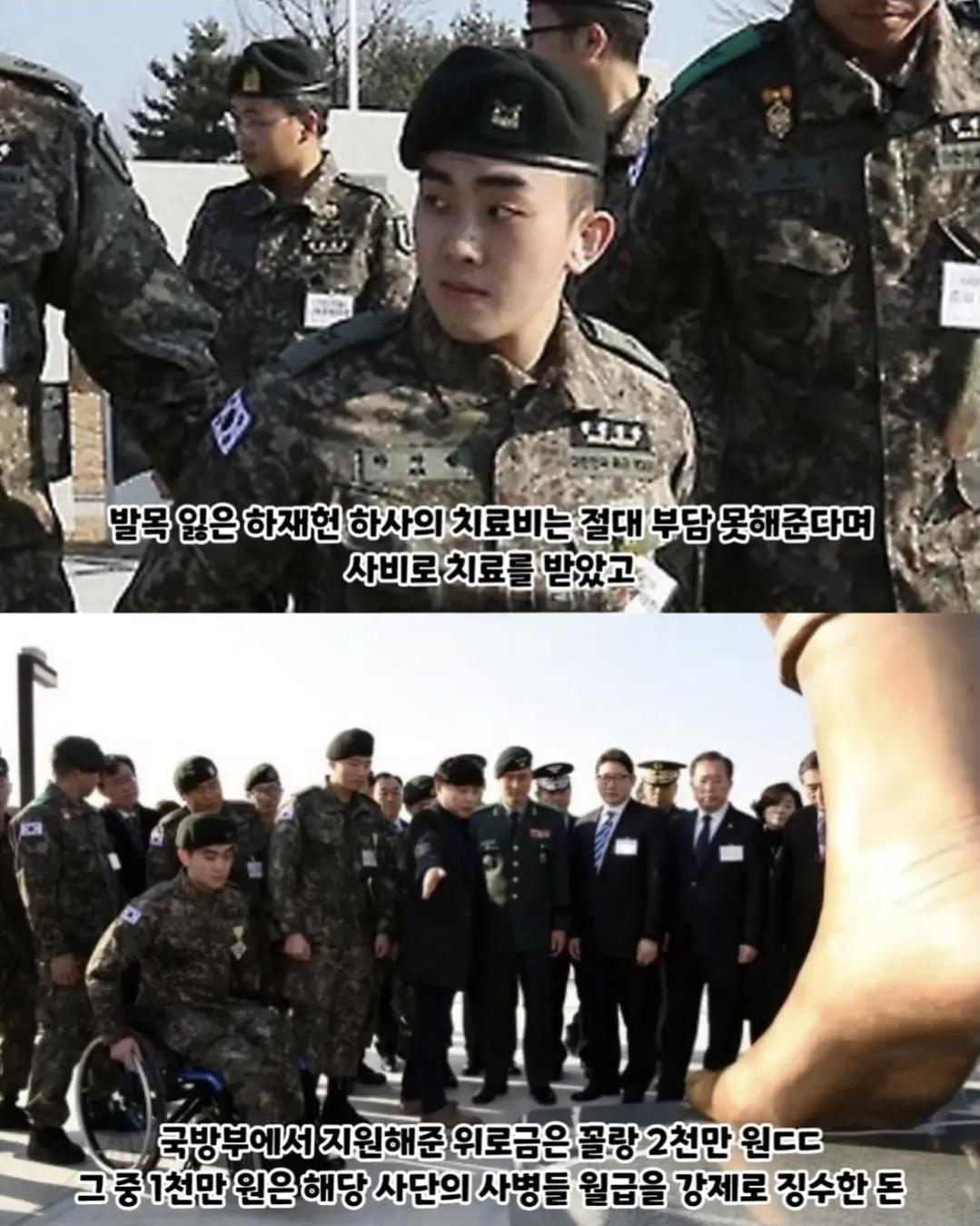 2억짜리  발목 동상 (3)