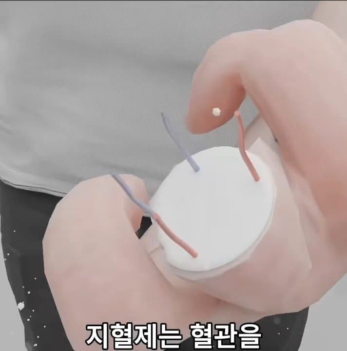 싱글벙글 손가락이 잘렸을 때 대처법 (20)