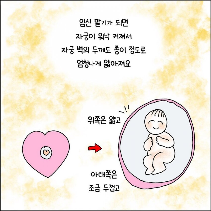 오싹오싹 산부인과에서 출산 중 자궁파열된 썰 (2)