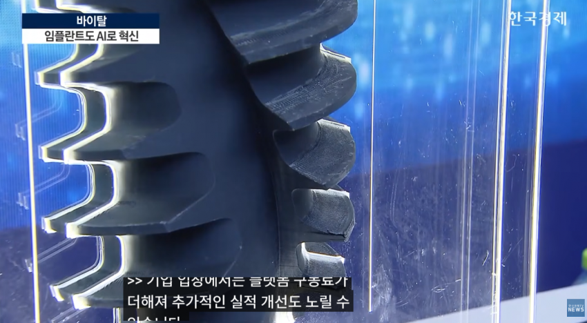 임플란트도 AI가 대세…수술 하루 만에 끝낸다 (15)
