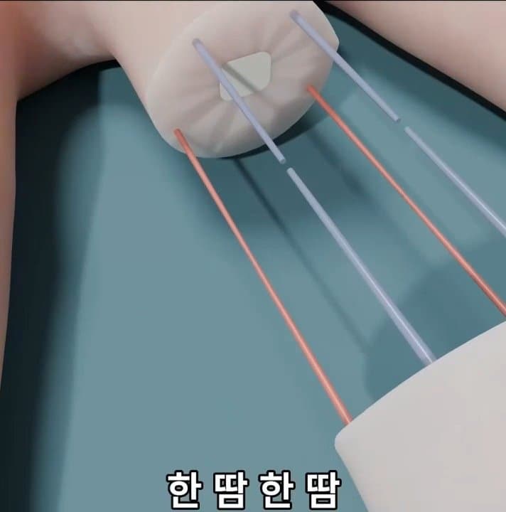싱글벙글 손가락이 잘렸을 때 대처법 (29)