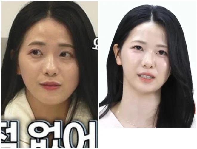 얼굴비대칭이 의미가 없는이유 (2)