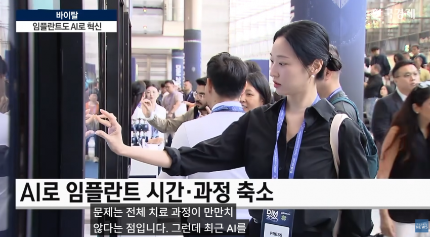 임플란트도 AI가 대세…수술 하루 만에 끝낸다 (4)