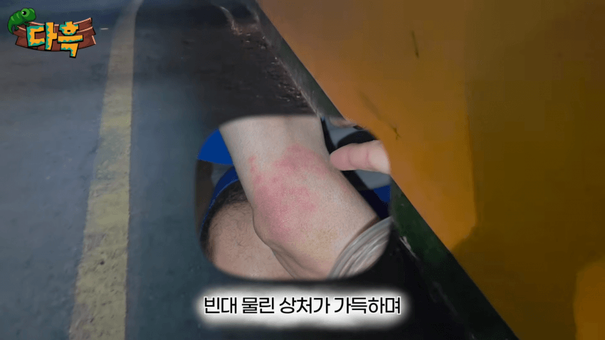 오싹오싹 부산 찜질방에 출몰해서 난리난 빈대(베드버그)상황 (5)