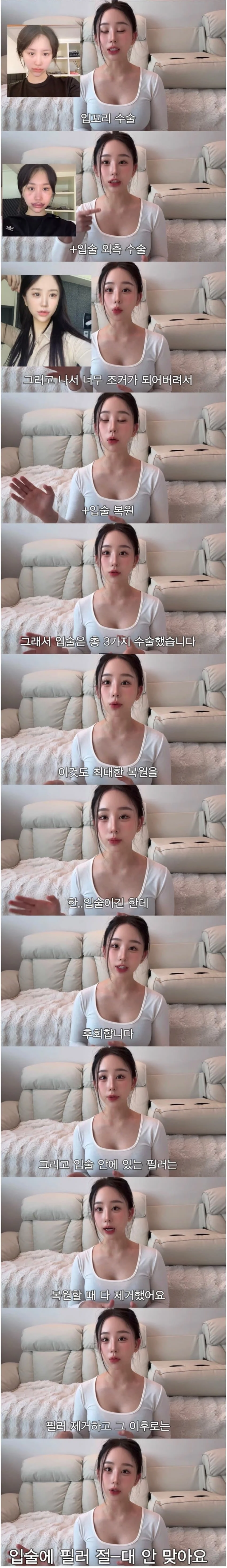 중2때부터 했던 성형 다 밝힌 유튜버