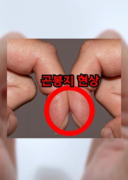 긴급) 지금 이동작 안되면 바로 병원에 가야 합니다! (6)