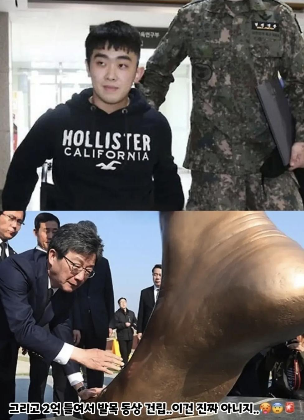 2억짜리  발목 동상 (4)