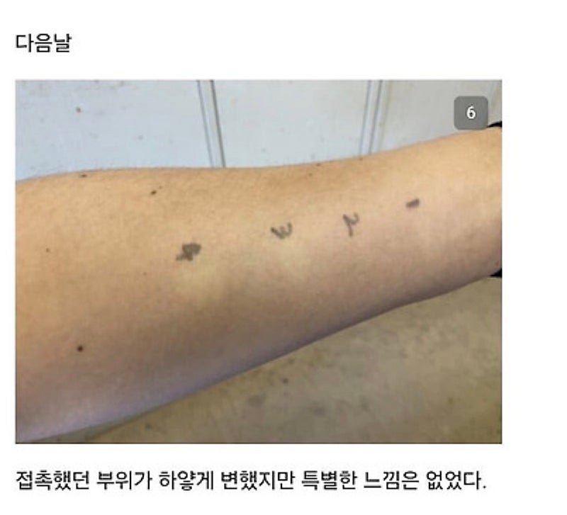 붉은사슴뿔버섯을 본인 몸에 실험한 일본인 (7)