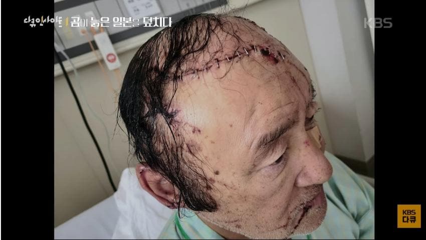 곰이 늙은 일본을 덮치다. 여고생 덮친 아키타 반달곰,, (22)