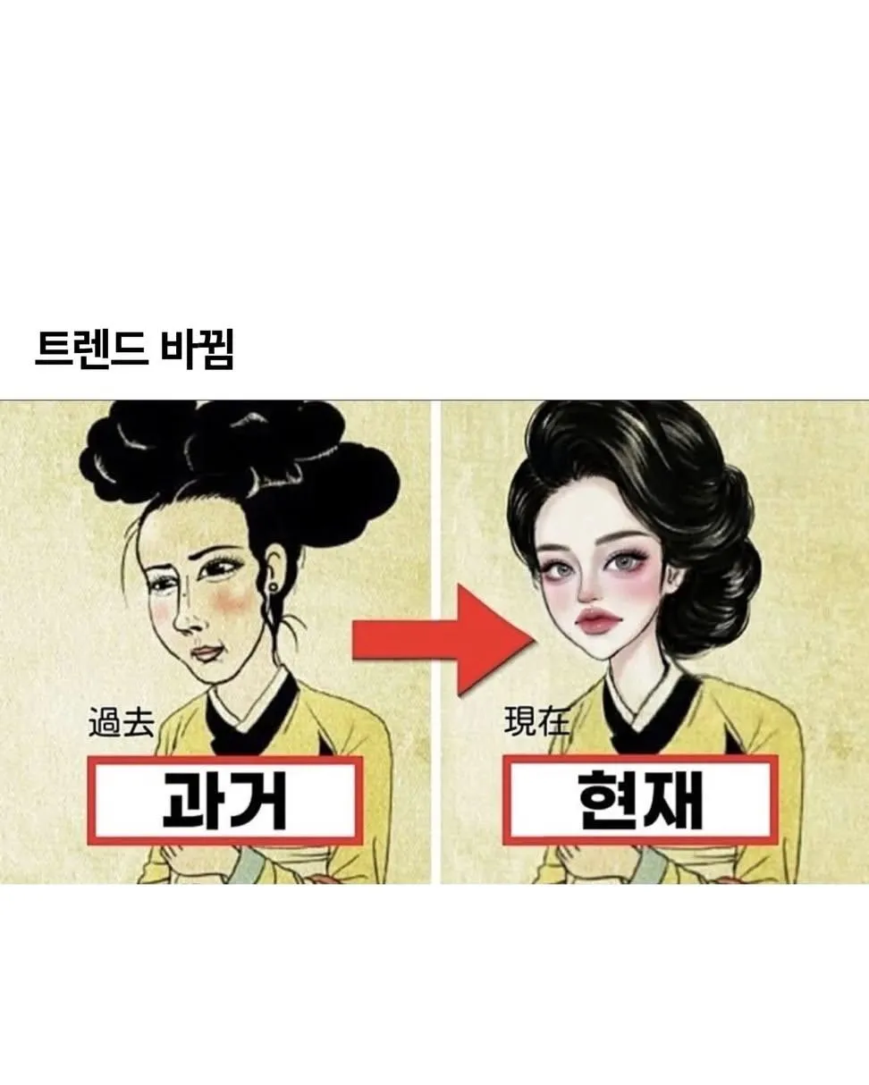 강남언니 트렌드