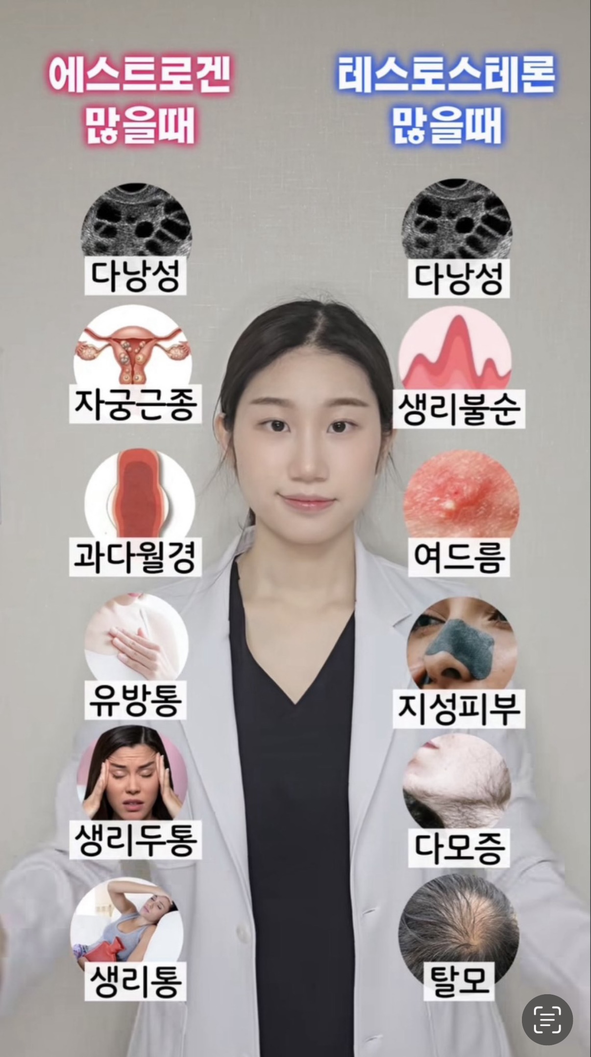 나는 테토녀인지 에겐녀인지 알아보는법