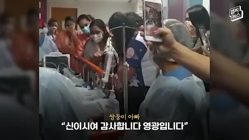 33시간 수술 끝에 얼굴 본 쌍둥이 (25)