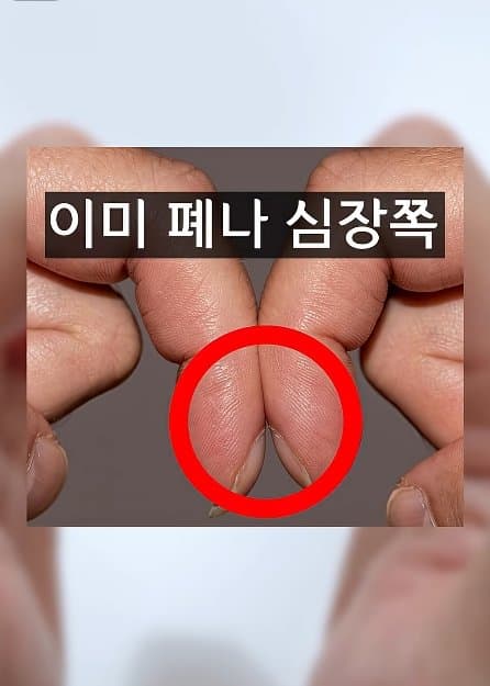 긴급) 지금 이동작 안되면 바로 병원에 가야 합니다! (7)