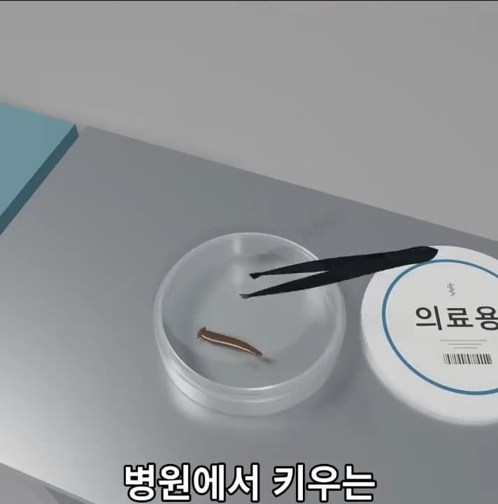 싱글벙글 손가락이 잘렸을 때 대처법 (44)