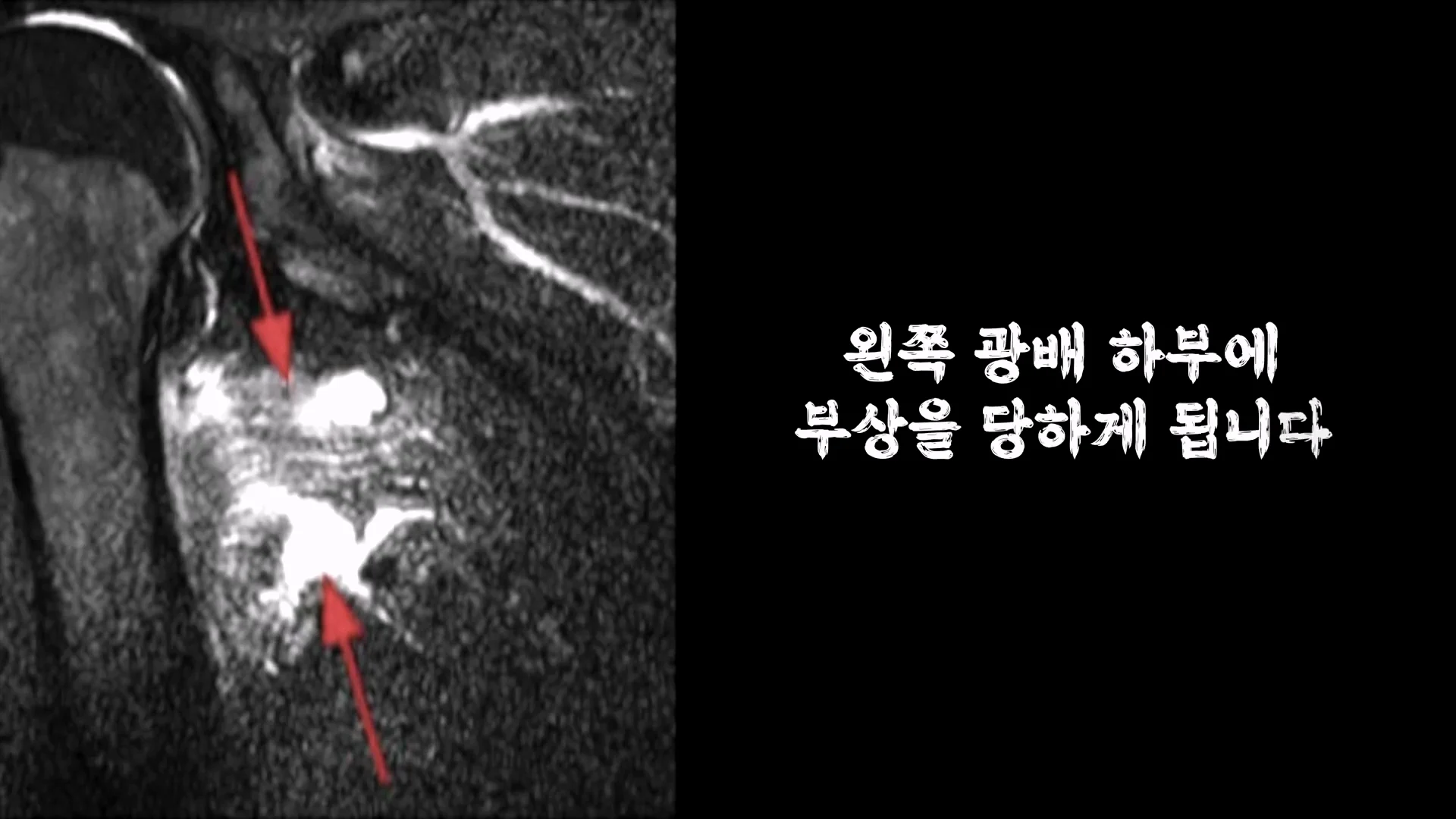 몸무게 46kg 남성의 3674일간의 헬스 기록 (9)