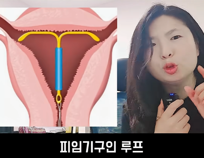 문제가 심각하다는 불임률 (17)
