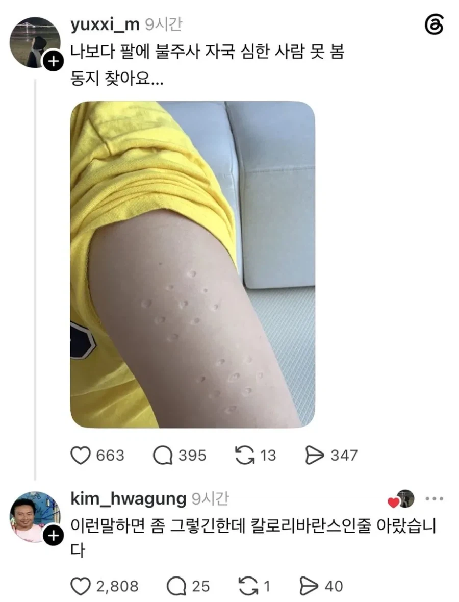 나보다 불주사 자국 심한사람 못봄