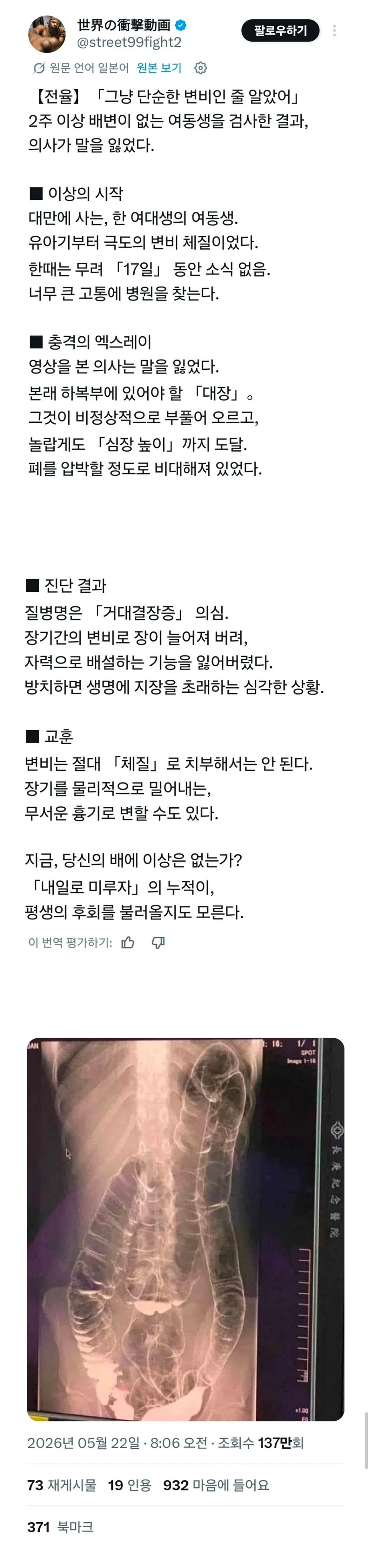 변비가 무서운 이유
