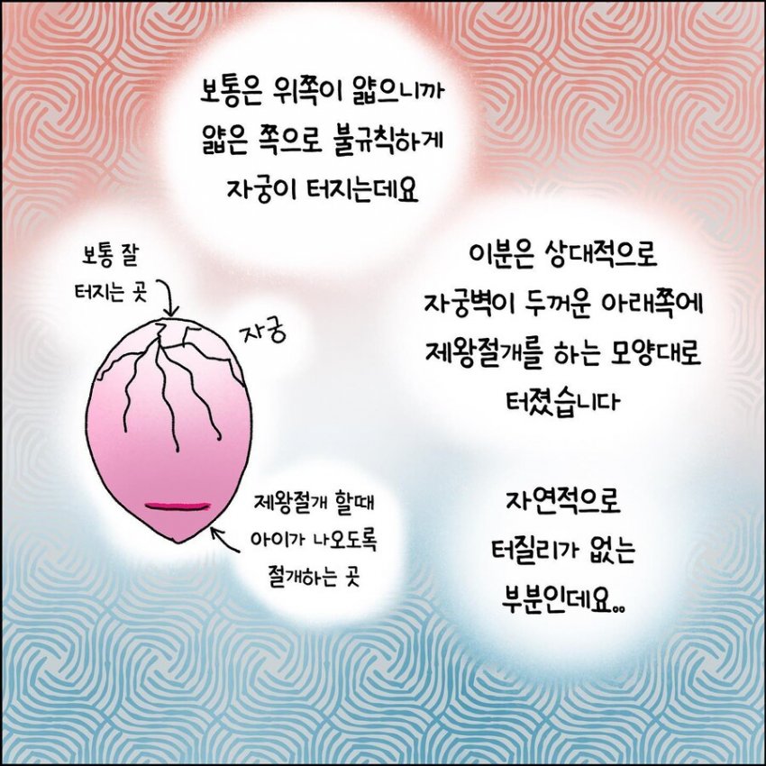 오싹오싹 산부인과에서 출산 중 자궁파열된 썰 (8)