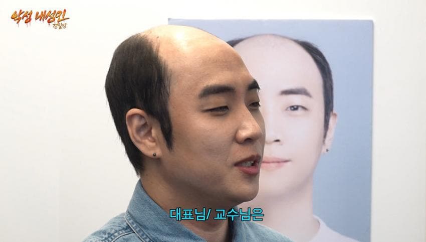 싱글벙글 21살부터 탈모였다는 올해 41살인 남자 사장 (8)