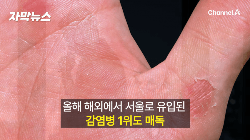 매독 감염자 확산, 한국 2030 남성 상당수(?) (6)