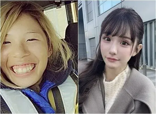 충격적인 2억원어치 성형결과..