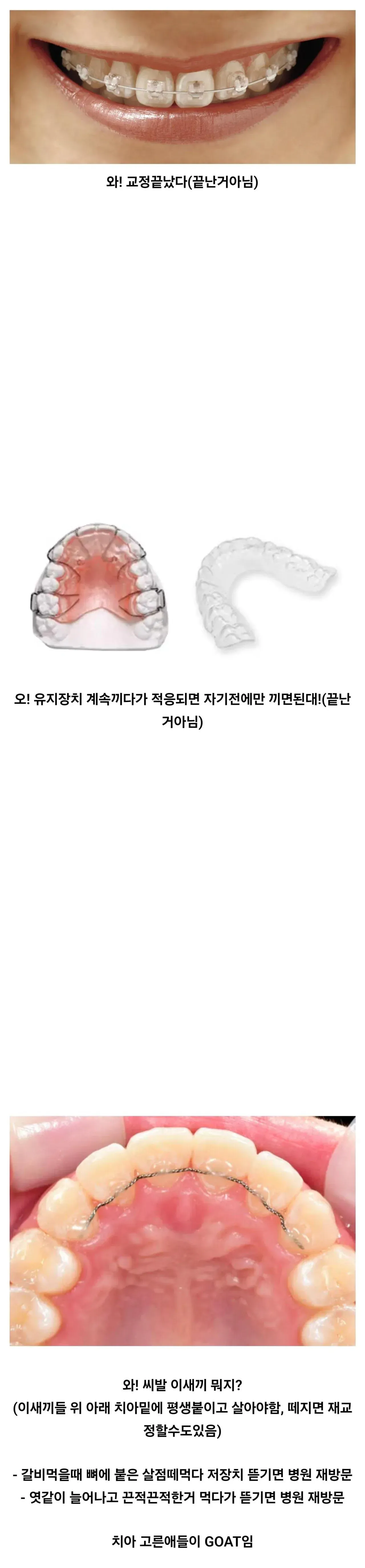 치아 가지런한게 큰 축복인 이유.