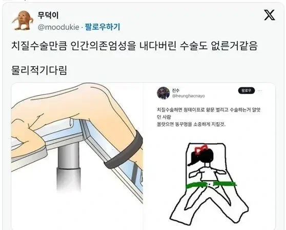 치질 수술할때 해야 한다는 자세 (3)