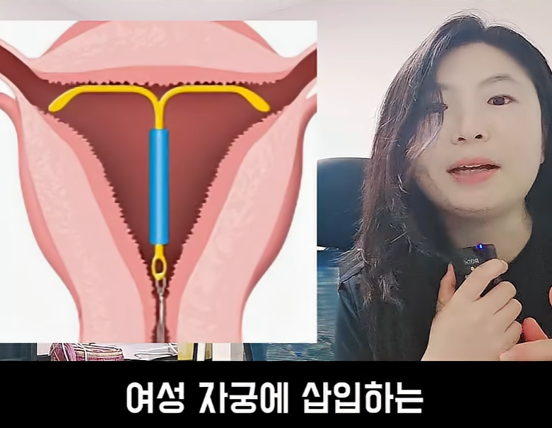 문제가 심각하다는 불임률 (16)