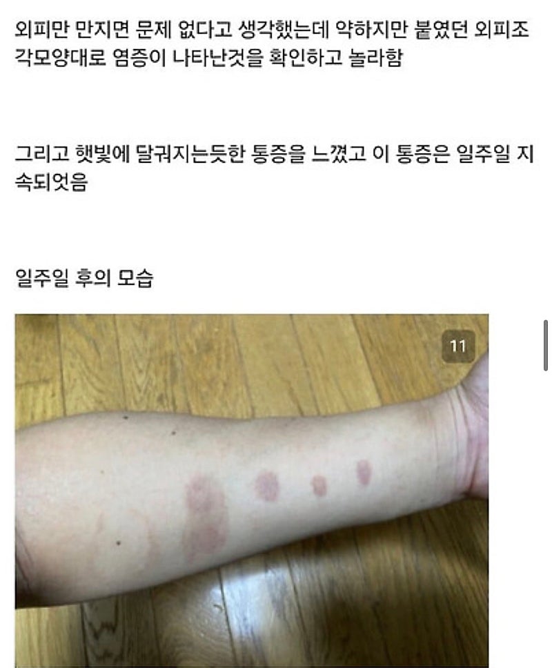 붉은사슴뿔버섯을 본인 몸에 실험한 일본인 (10)