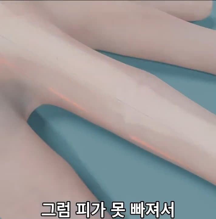 싱글벙글 손가락이 잘렸을 때 대처법 (40)