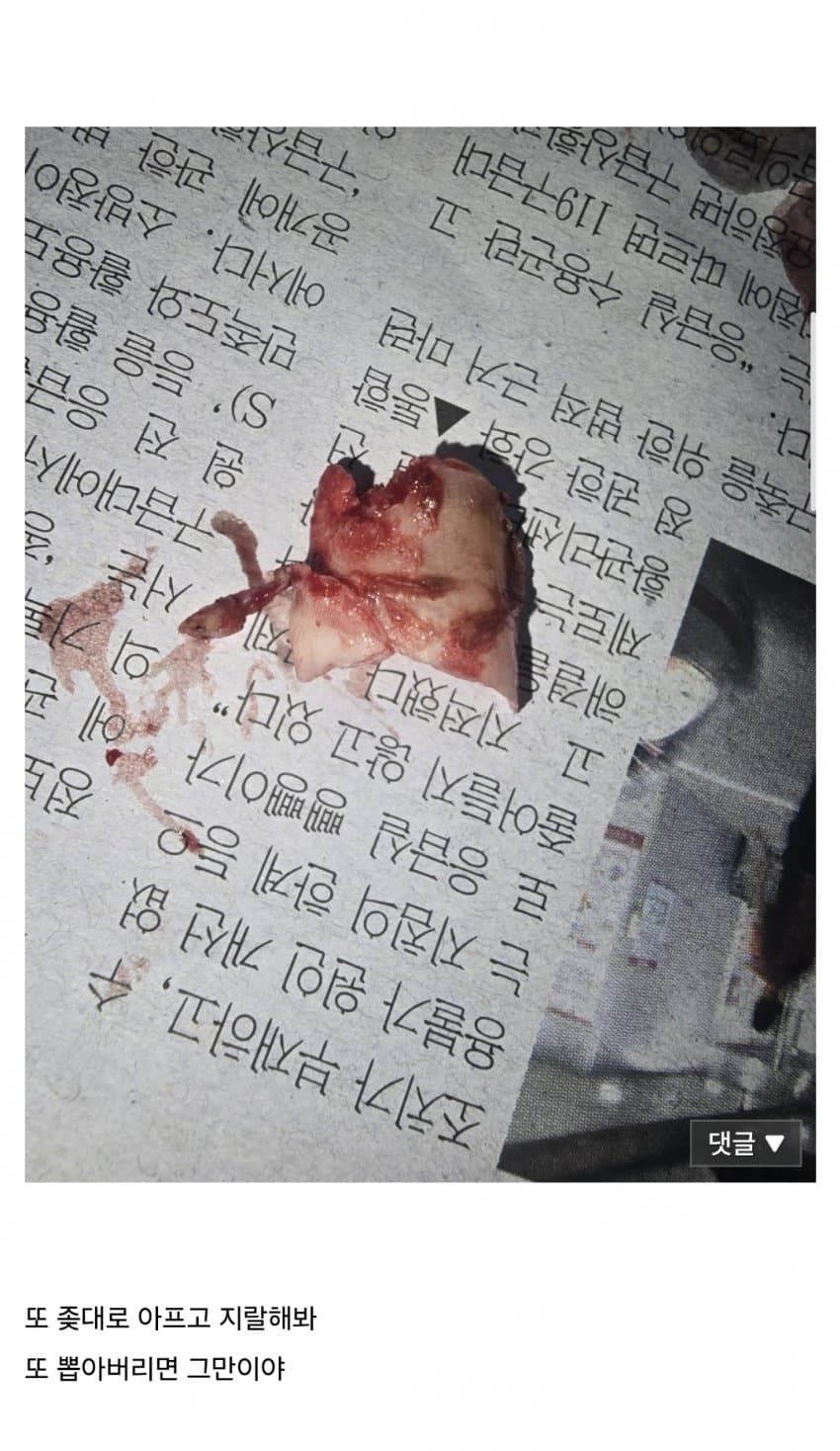 (혐) 인간의 정신력을 볼 수 있는 갤러리 (5)