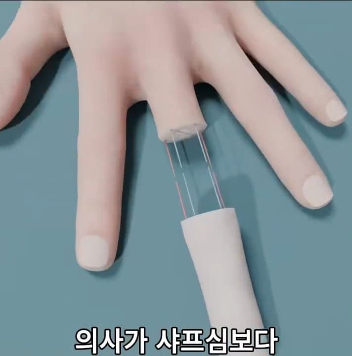 싱글벙글 손가락이 잘렸을 때 대처법 (27)
