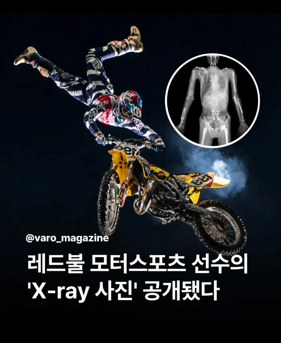 익스트림 스포츠의 전설이 되는법 1단계