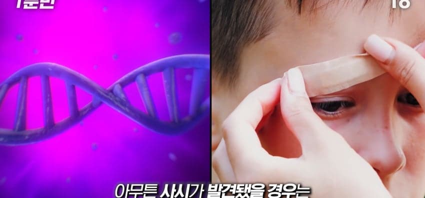 사시는 과연 어떻게 보일까...? (31)