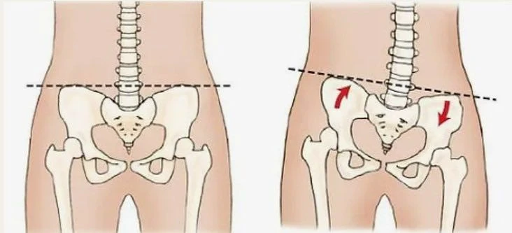 일본에서 핫하다는 골반 교정법