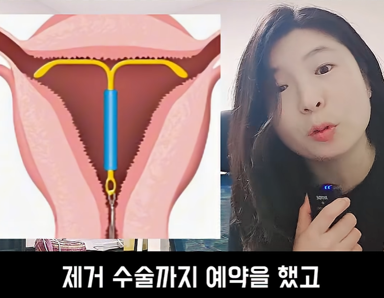 문제가 심각하다는 불임률 (19)