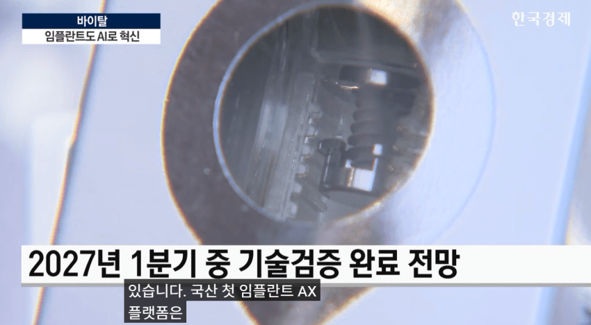 임플란트도 AI가 대세…수술 하루 만에 끝낸다 (16)