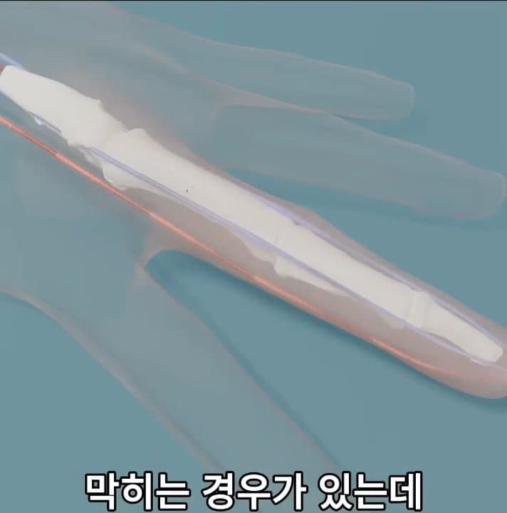싱글벙글 손가락이 잘렸을 때 대처법 (35)