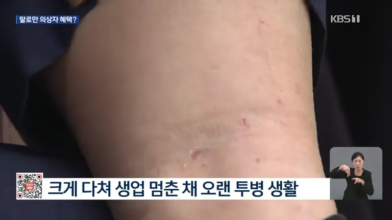 “괜히 도왔나 후회”…의상자 혜택도 ‘소멸시효’ 따진 건보공단 (4)