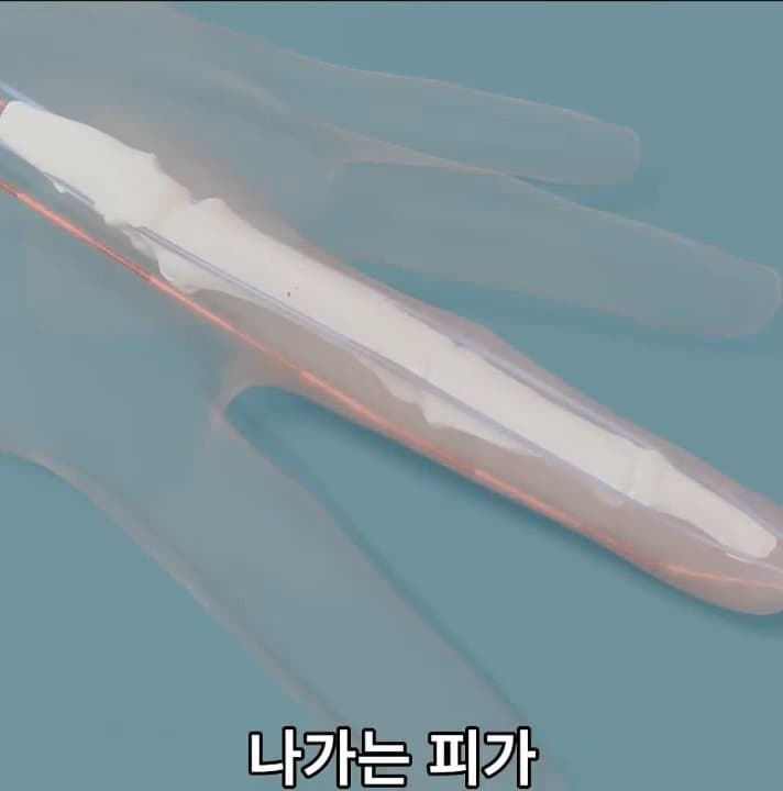 싱글벙글 손가락이 잘렸을 때 대처법 (34)