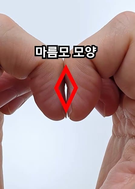 긴급) 지금 이동작 안되면 바로 병원에 가야 합니다! (4)