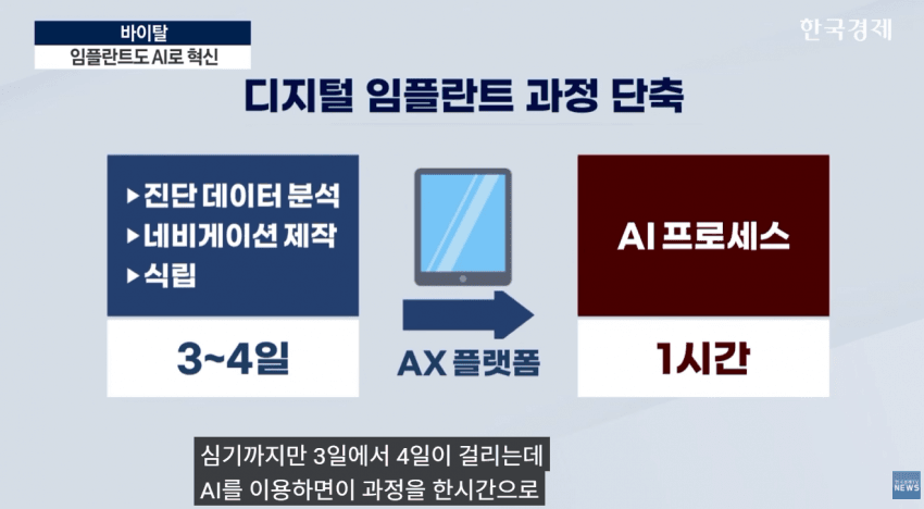 임플란트도 AI가 대세…수술 하루 만에 끝낸다 (8)