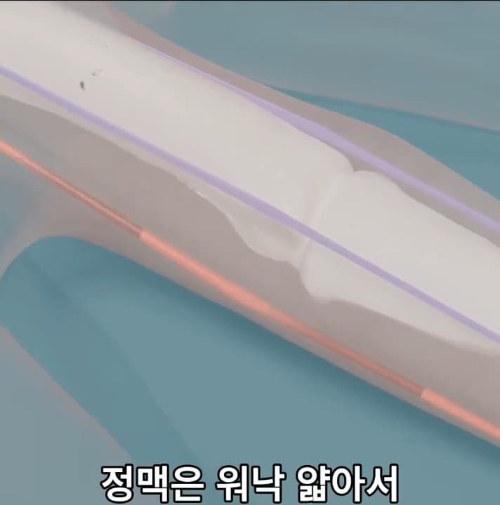 싱글벙글 손가락이 잘렸을 때 대처법 (38)