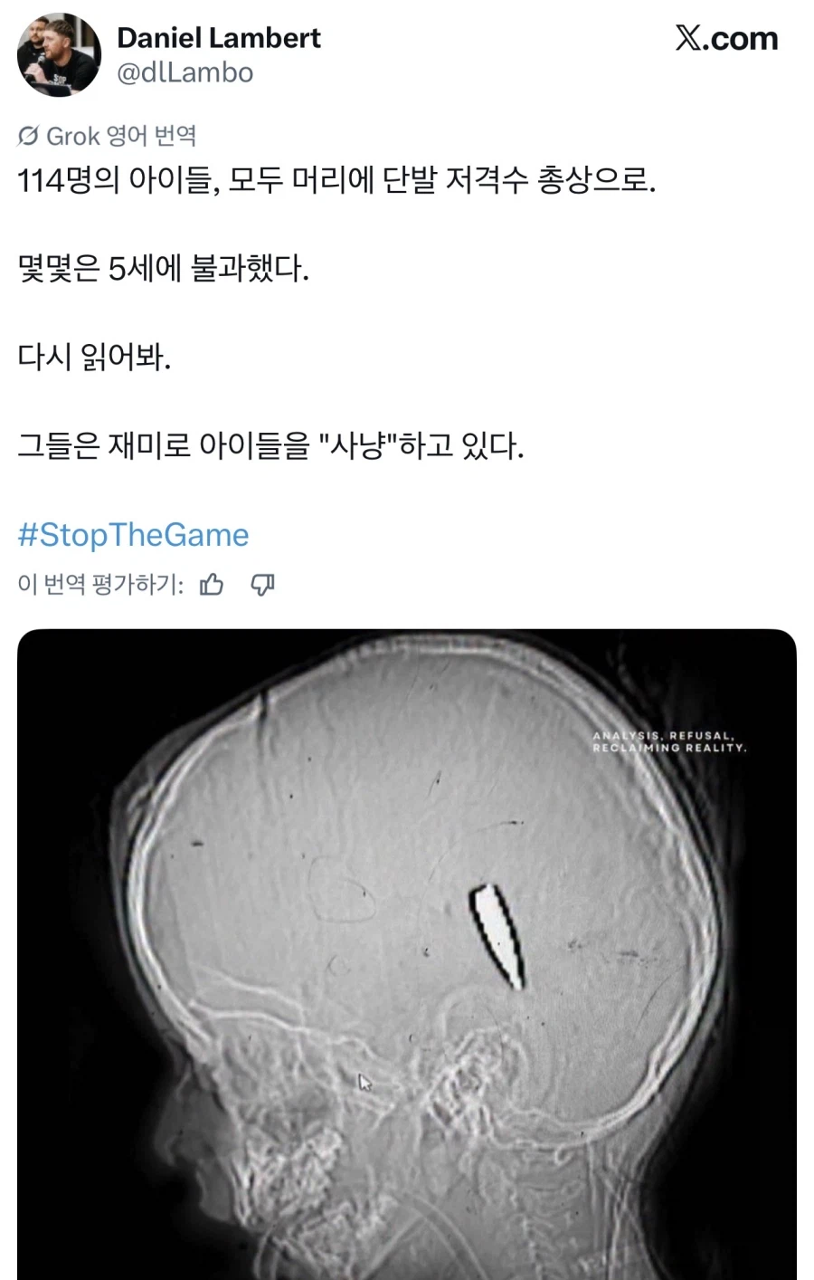 진짜 정신나갈것 같은 이스라엘 근황