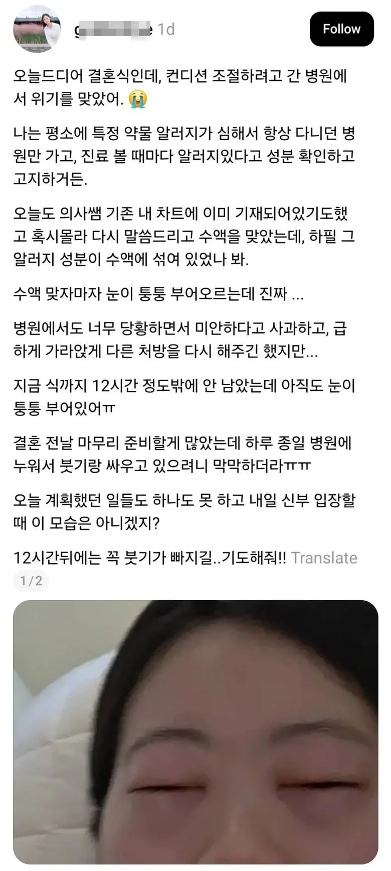 X] 결혼식 전 의료사고 당한 신부.twt
