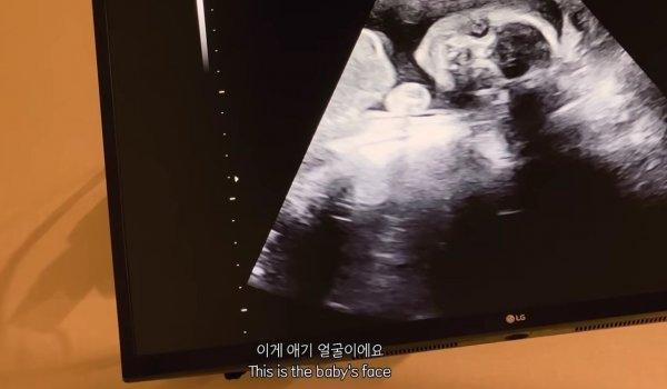 박주호 선수 아내 근황 ㄷㄷ (2)