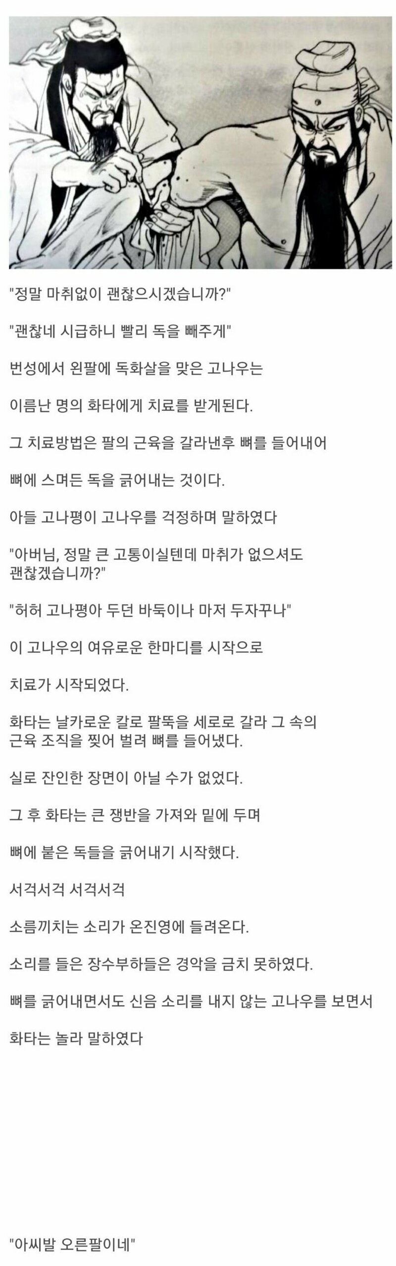 고대부터 전해져오는 관우 화타썰