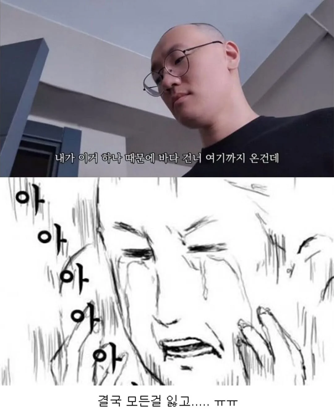 터키로 모발이식 받으러간 남자의 최후 (6)