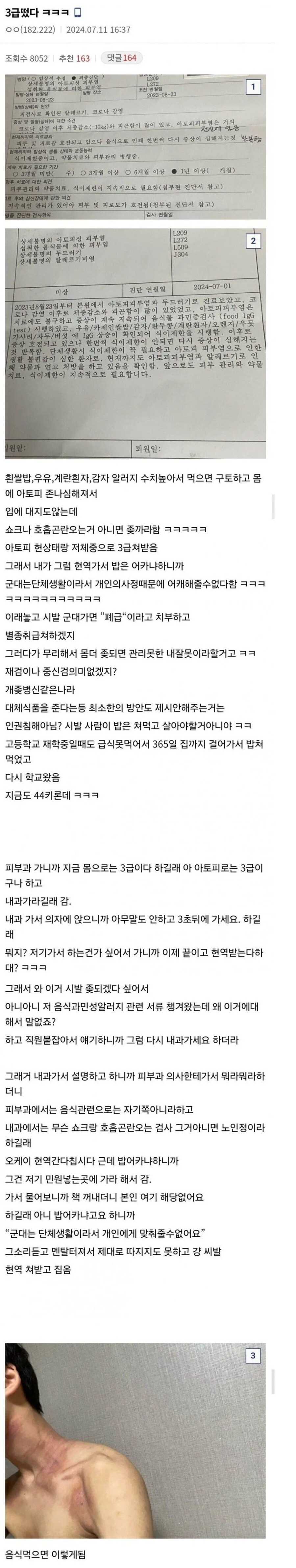 쌀 알레르기가 있는데 군대가는 썰